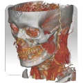 DroidRender - 3D DICOM viewer