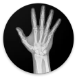 Bone age icon