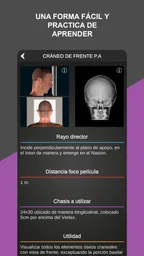 RX - Posiciones Radiológicas 3