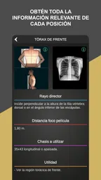 RX - Posiciones Radiológicas 4