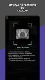 RX - Posiciones Radiológicas 6