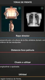 RX - Posiciones Radiológicas 8
