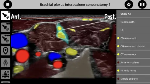 AnSo Anaesthesia Sonoanatomy 1