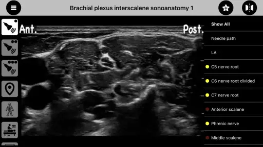 AnSo Anaesthesia Sonoanatomy 3
