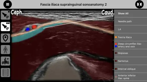 AnSo Anaesthesia Sonoanatomy 4