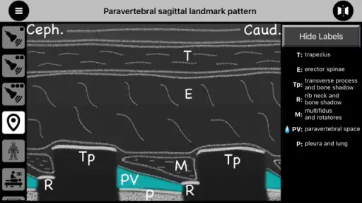AnSo Anaesthesia Sonoanatomy 8