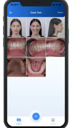 Dental Shooting 2