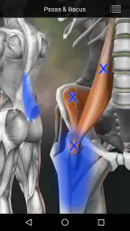Muscle Trigger Point Anatomy 3
