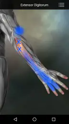 Muscle Trigger Point Anatomy 4