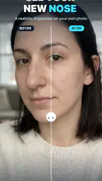 Nose Job - Plastic Surgery AI 8