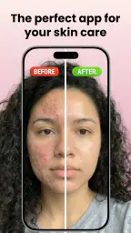 Skin Care Scanner: GlowUp 1