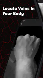 X-Vein 1