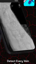 X-Vein 2