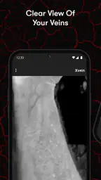 X-Vein 3