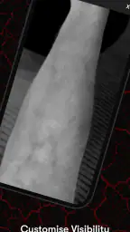 X-Vein 4