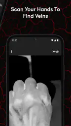 X-Vein 5