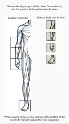 X-Vein 6