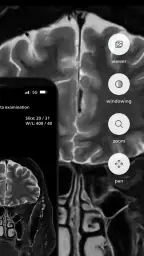 Philips MR Imaging 6