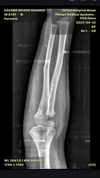 DICOM Viewer 2