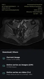 DICOM Viewer 8