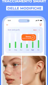 AI Scaner salute pelle Skinive screenshot