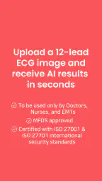 ECG Buddy | ECG Analysis AI 2
