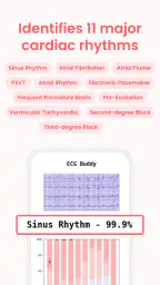 ECG Buddy | ECG Analysis AI 3