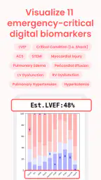 ECG Buddy | ECG Analysis AI 4