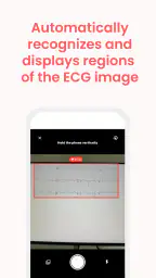 ECG Buddy | ECG Analysis AI 5