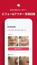 AGE-R - medicubeデジタルクリニック 3