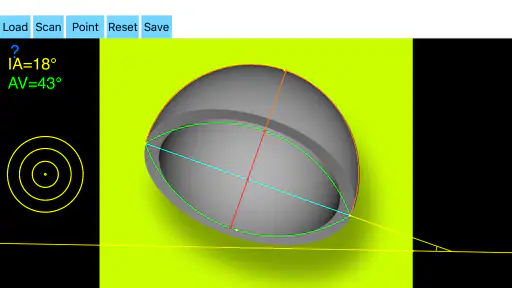 CupAnteversionInclinationApp 8
