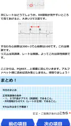 みんなde心電図 8