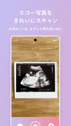 エコー写真　スキャンして簡単整理！ 1