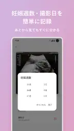 エコー写真　スキャンして簡単整理！ 2