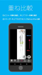 グリッド線撮影アプリ Professional 4