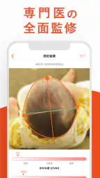 赤ちゃんの頭のかたち測定 3