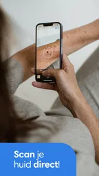 SkinVision - herken huidkanker 2