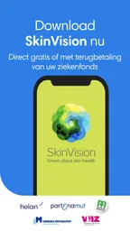 SkinVision - herken huidkanker 5
