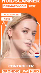 AI Huidmonitor scan - Skinive 1