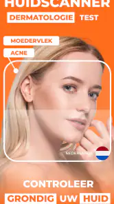 AI Huidmonitor scan - Skinive screenshot
