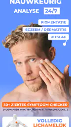 AI Huidmonitor scan - Skinive 2