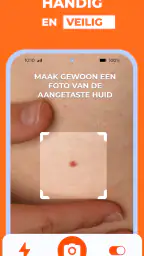 AI Huidmonitor scan - Skinive 3