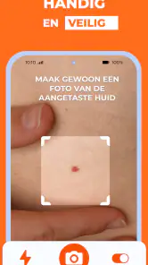 AI Huidmonitor scan - Skinive screenshot