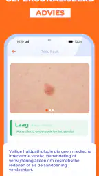 AI Huidmonitor scan - Skinive 5