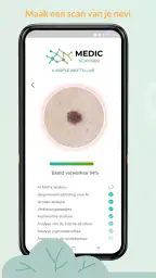Medic Scanner - huidanalyse 3