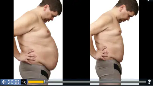 Plastic Surgery Simulator 3