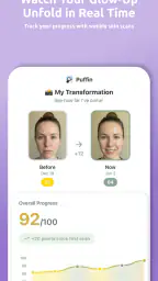 Puffin: Acne Tracker 5