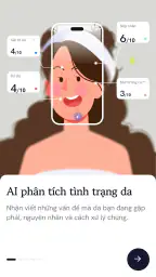 Skindex AI 2