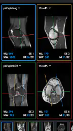 IDV - IMAIOS DICOM Viewer 3