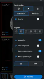 IDV - IMAIOS DICOM Viewer 4